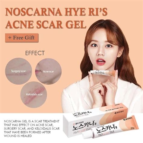 Korea Factory Wholesale Price Noscana Gel Cream Dark Scar Noscana Gel ...