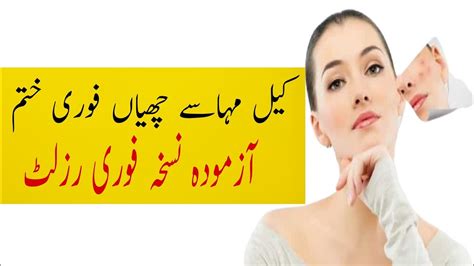 Pimple Acne Remove Karny Ka Tarika Skin And Hair Secret Youtube