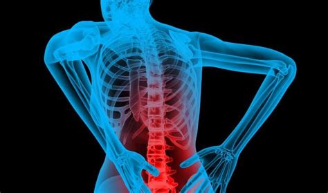 Back Pain (Lower and Upper) : Symptoms, Causes, Treatment