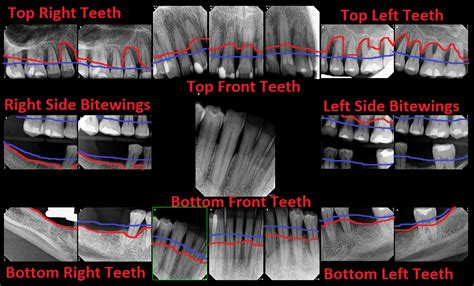 Dental Radiology Fmx