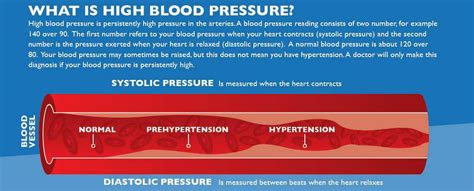 Common Comorbidities Covid-19 Update | Hypertension | Type 2 Diabetes