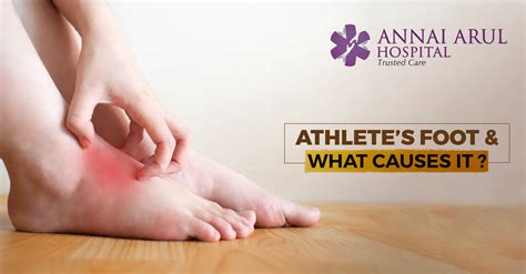 ATHLETE’S FOOT AND WHAT CAUSES IT? – Multispeciality Hospitals in Chennai