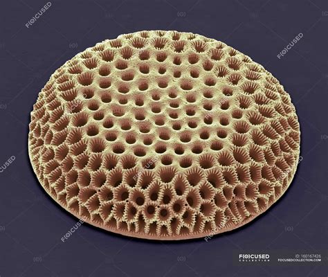 Diatoms Single Celled Algae — Microbiology Pitted Stock Photo