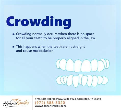 We Can Successfully Correct Crowding Of Teeth With The Orthodontic