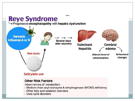 Kawasaki Disease Formerly Known As Mucocutaneous Lymph Node