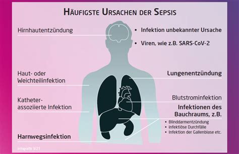 Wenn Infektionen Eskalieren Unterschätzter Notfall Sepsis