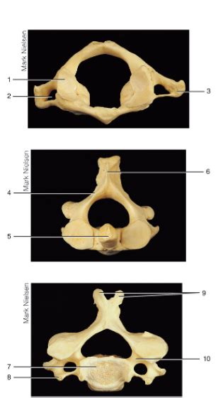 C1, C2, Cervical Vertebrae Diagram Diagram | Quizlet