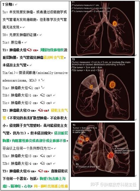 怎么确定肺癌的分期？ 知乎