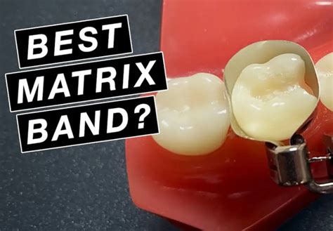 Beyond Dentistry Discusses The Best Matrix Band For Composite Greater