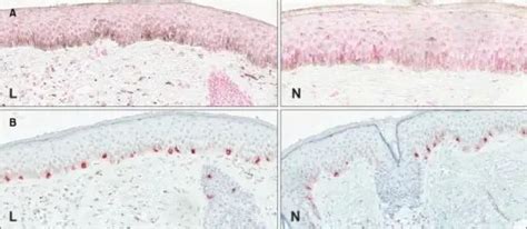 What are Disorders of Pigmentation and Melanocytes? - Pathosomes