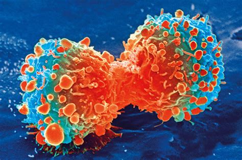 Why The Presence Of Healthy Cells Enables Cancer To Resist Treatment