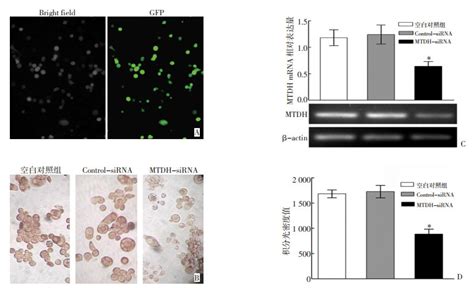 Mtdh基因下调抑制人乳腺癌mda Mb 453细胞增殖同黏附和迁移的研究