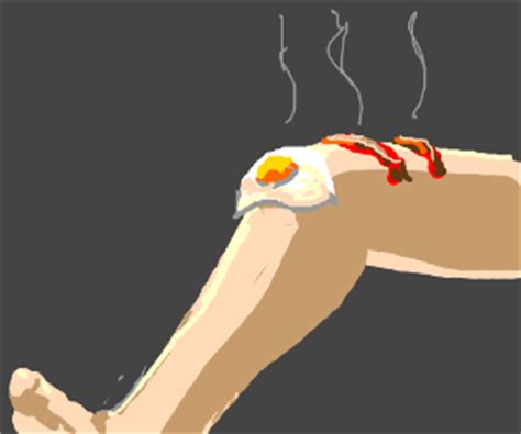 Leg So Hot Hot Hot Leg Leg So Hot U Fry An Egg Drawception