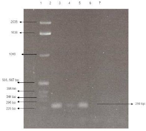 Amplified PCR products from various sample sources of total cells and ... 