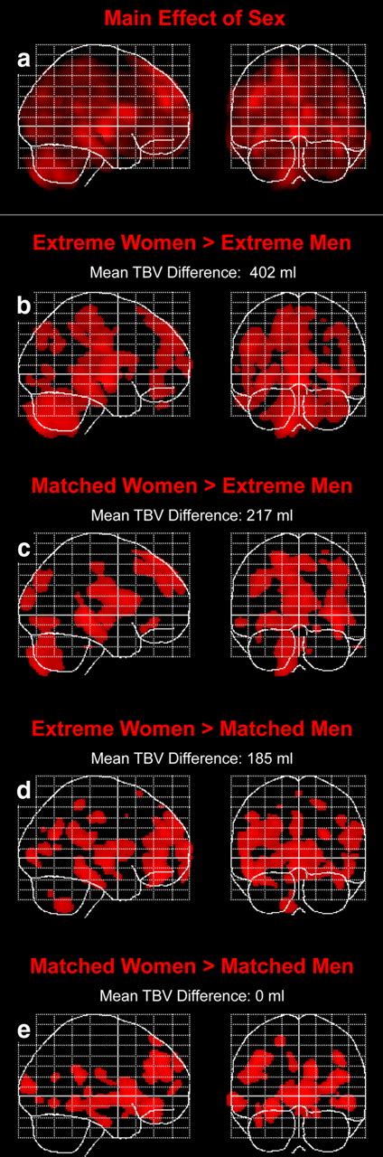 Why Sex Matters Brain Size Independent Differences In Gray Matter