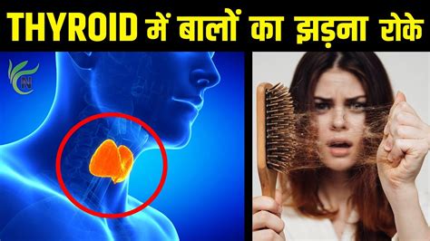 थायराइड में बालों का झड़ना रोकने में मददगार नुस्खे Remedies For