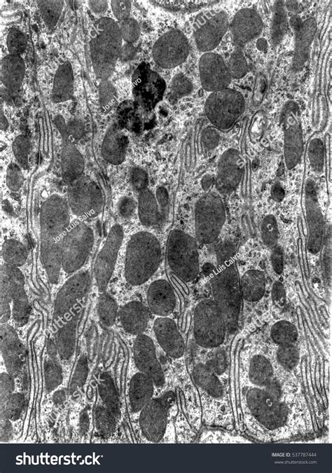 Transmission Electron Microscope Tem Micrograph Showing Stock Photo ...