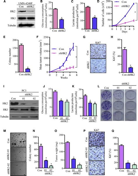 Depletion Of Hk Suppresses Pten P Deficiency Driven Prostate Cancer