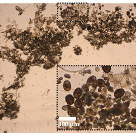 Digitally zoomed images of identified parasite eggs with our system ...