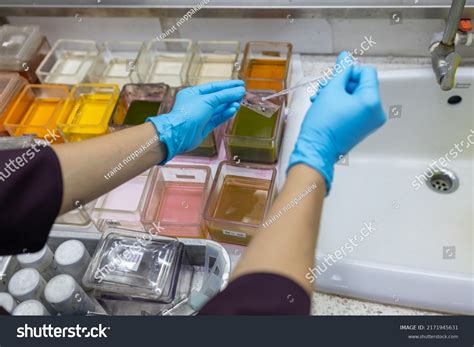 Medical Scientists Preparing Cytology Slides Cervical Stock Photo 2171945631 | Shutterstock