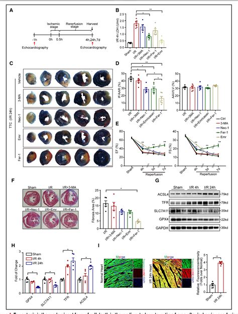 Figure From Alox Hpete Aggravates Myocardial Ischemia