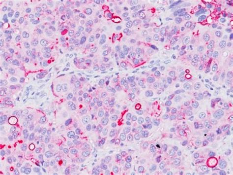 Epithelial Membrane Antigen Ema Mc Genebiosolution