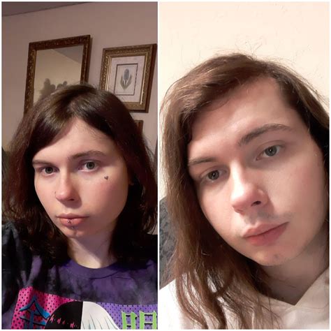 Left 15 Months Hrt Right 1 Day Hrt Gotta Say I M Impressed With My Progress 😊 24 Mtf R