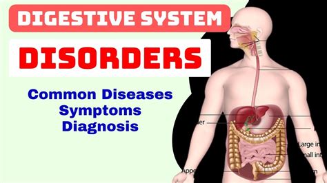 Digestive System Common Diseases