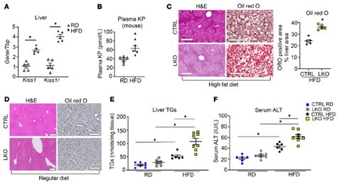 Hepatic Kiss R Knockout Mice Exhibit Increased Hepatic Steatosis In A