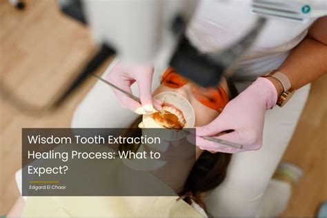 Wisdom Tooth Extraction Healing Process What To Expect