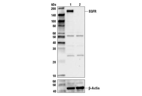 Egf Receptor Antibody Cell Signaling Technology