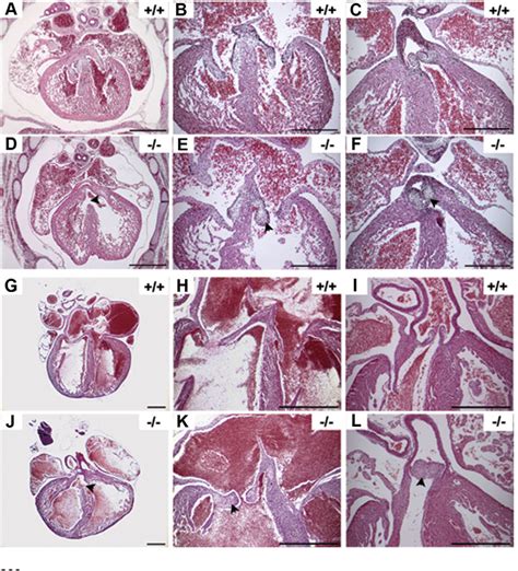 Figure 5 From Multiple Congenital Malformations Of Wolf Hirschhorn