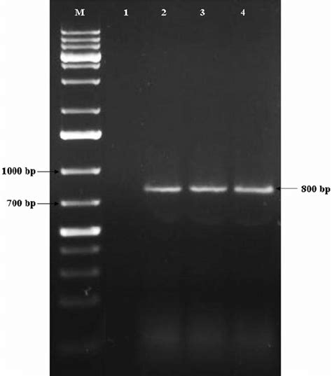 Agarose Gel Electrophoresis Of Rt Pcr Products Lane M Kb Dna Ladder