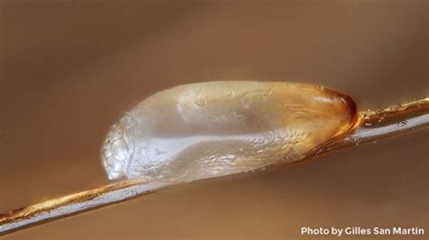 Eggs laid by head lice can attach to human hair for 10,000 years ...