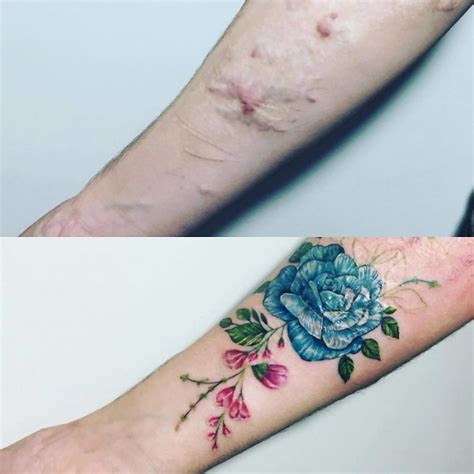 Ideas De Tatuajes Para Tapar Cicatrices En El Cuerpo TATUAJES CON