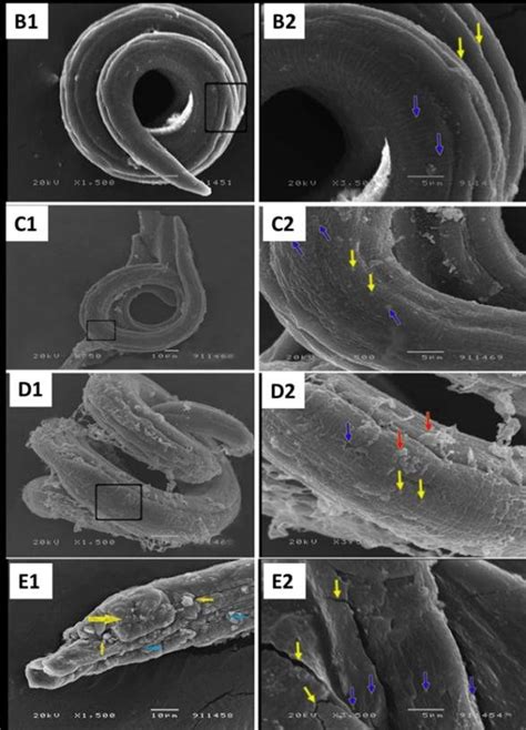 Trichinella Larvae