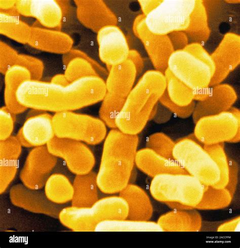 E Coli Bakterien Farbige Scanning Electron Micrograph Sem Von