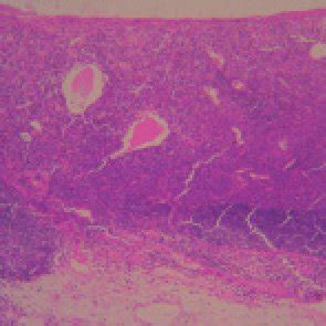 Large, polygonal epithelioid cells, characterized by abundant cytoplasm... | Download Scientific ...