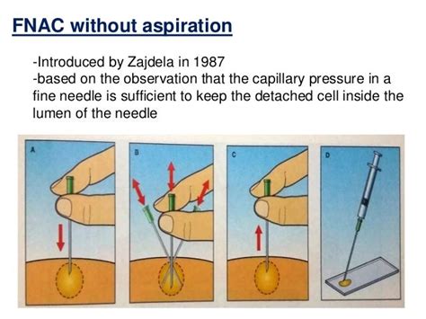 Fine Needle Aspiration Cytology Fnac