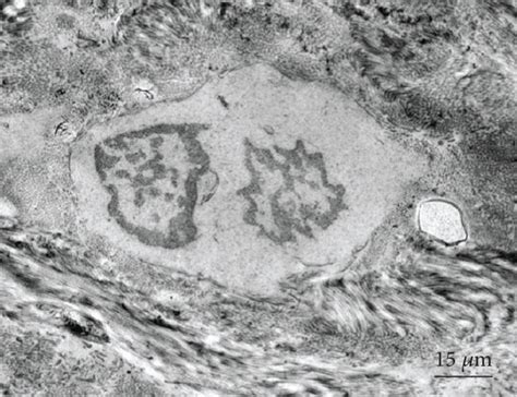 Transmission Electron Microscopy Of Reimplanted Bone A Osteoblasts