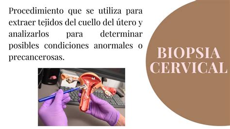 Biopsia Cervical Alondra Franco UDocz