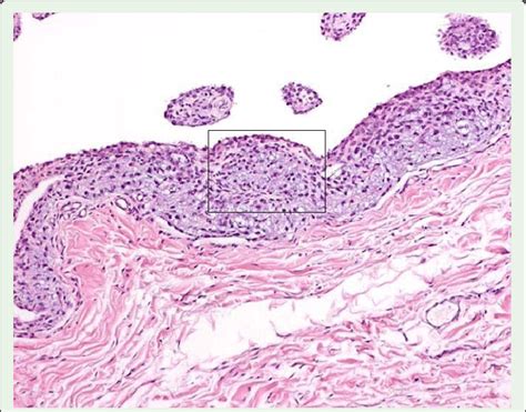 Synovial Membrane Histology