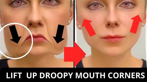 Marionette Lines How To Lift Up Droopy Lips Corners Face Yoga For