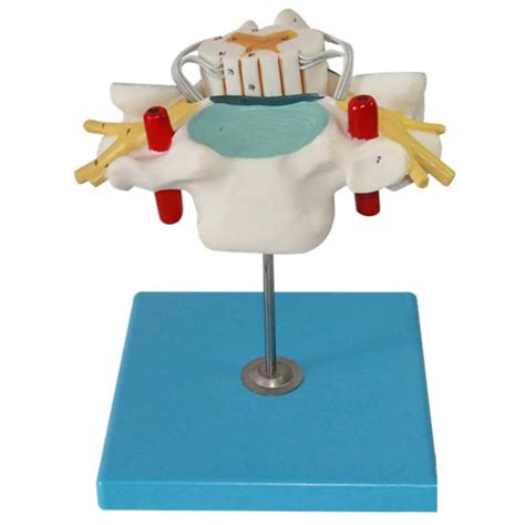 Buy SKUAI Body Model Cervical Spinal Cord And Spinal Nerve Ment Model