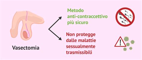 La Vasectomia E Le Sue Implicazioni