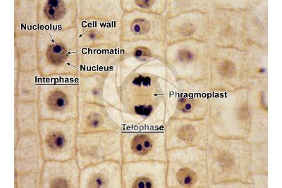 Telophase - Root - Allium (Onion) - Amaryllidaceae - Liliopsida ...