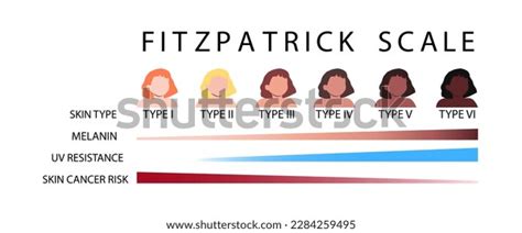 Fitzpatrick Scale Skin Types Infographic Female Stock Vector Royalty