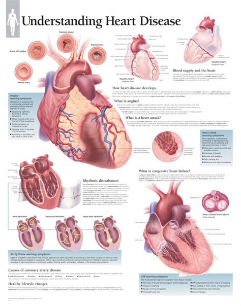 Understanding Hypertension Study Set Scientific Publishing