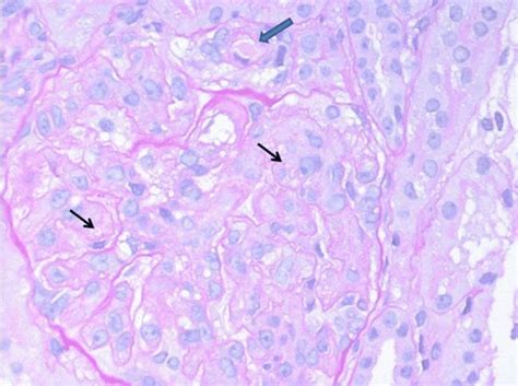 Histology Of Capillaries