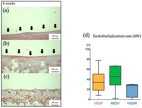 Prosthesis Free Full Text Development Of Small Diameter Artificial